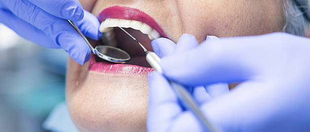 Best Dental Abscess Treatment in Mariemont, OH